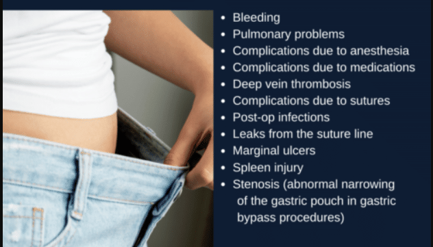 The Hidden Dangers Of Weight Loss Surgery